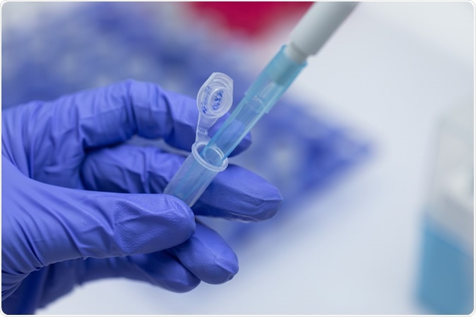 Polymerase Chain Reaction (PCR) and Agarose gel electrophoresis is a method of gel electrophoresis used in biochemistry, molecular biology, genetics, and clinical chemistry in lab. Credit: Rattiya Thongdumhyu / Shutterstock