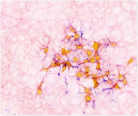 Breast cancer cells hibernate in the lung before forming secondary tumors