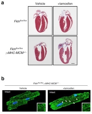 Study reveals molecular pathogenesis of muscular dystrophy-associated cardiomyopathy