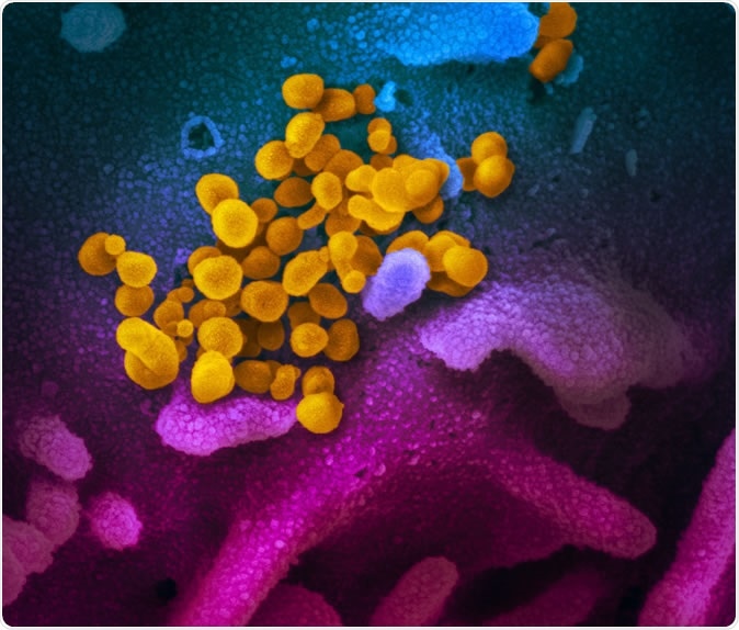 Novel Coronavirus SARS-CoV-2 This scanning electron microscope image shows SARS-CoV-2 (yellow)—also known as 2019-nCoV, the virus that causes COVID-19—isolated from a patient in the U.S., emerging from the surface of cells (blue/pink) cultured in the lab. Credit: NIAID-RML