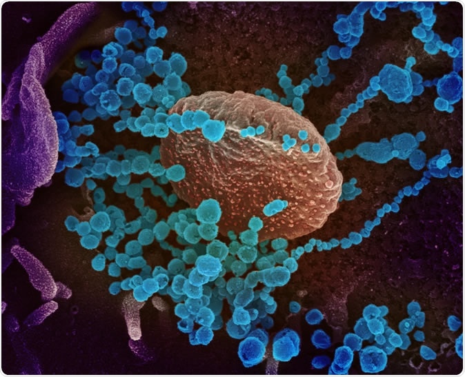Novel Coronavirus SARS-CoV-2 This scanning electron microscope image shows SARS-CoV-2 (round blue objects) emerging from the surface of cells cultured in the lab. SARS-CoV-2, also known as 2019-nCoV, is the virus that causes COVID-19. The virus shown was isolated from a patient in the U.S. Credit: NIAID-RML