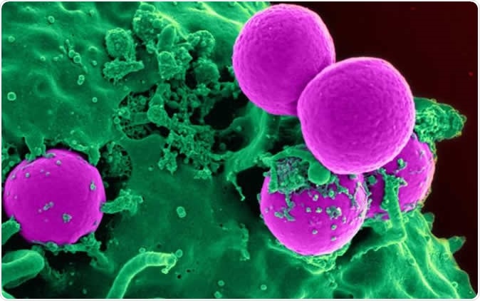 Human neutrophil ingesting MRSA (Source: National Institutes of Health (NIH))
