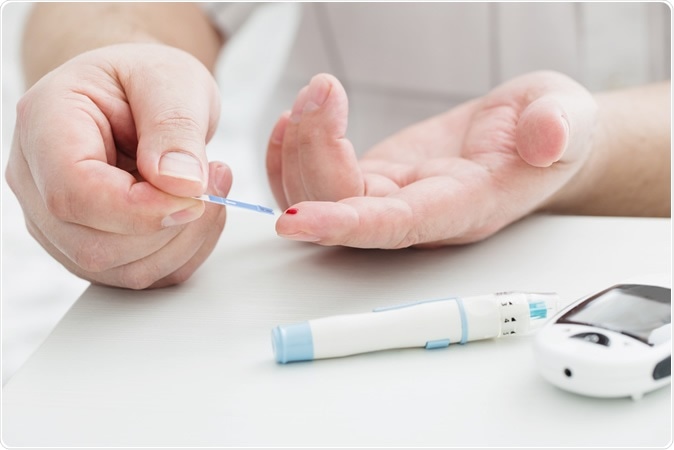 Image Credit: Maya Kruchankova / Shutterstock