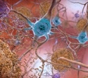 Researchers identify enzyme linked to myelin damage and neurodegenerative conditions