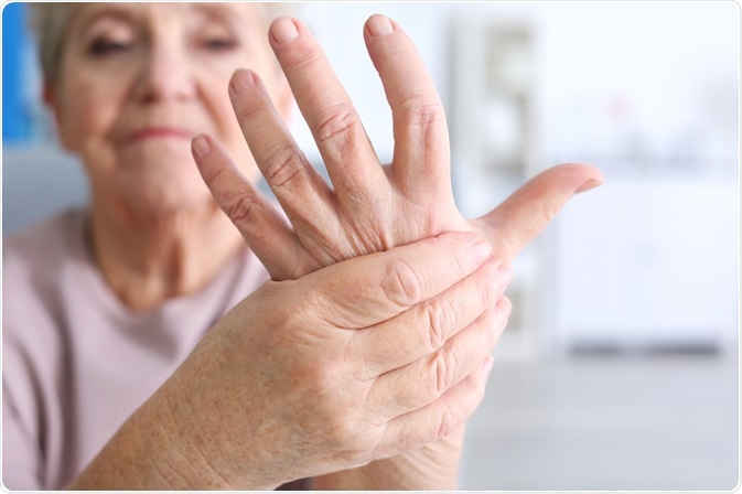 Rheumatoid Arthritis