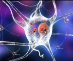 Using Antibodies for Parkinson's Disease Research