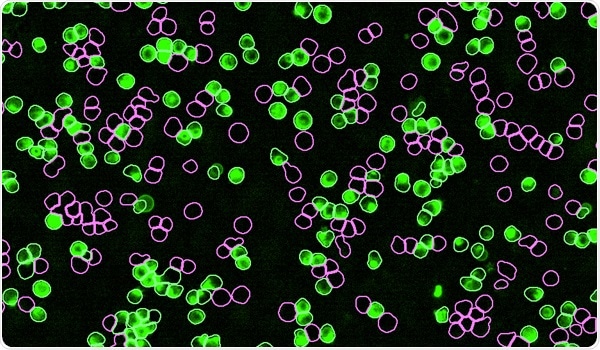 IncuCyte® SX1 Live-Cell Analysis System