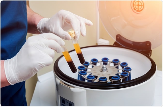 Study: Early Safety Indicators of COVID-19 Convalescent Plasma in 5,000 Patients. Image Credit: Roman Zaiets / Shutterstock