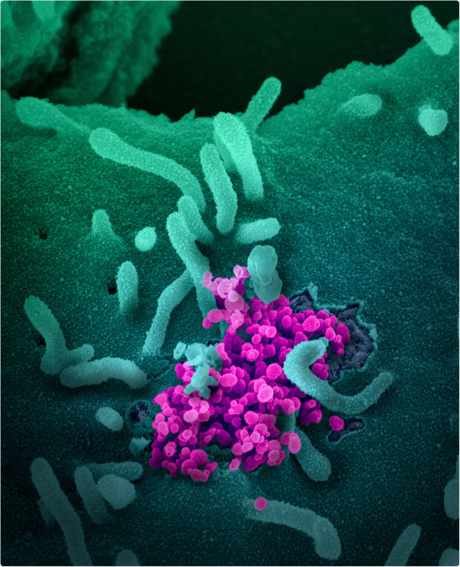 Novel Coronavirus SARS-CoV-2 This scanning electron microscope image shows SARS-CoV-2 (round magenta objects) emerging from the surface of cells cultured in the lab. SARS-CoV-2, also known as 2019-nCoV, is the virus that causes COVID-19. The virus shown was isolated from a patient in the U.S. Image captured and colorized at NIAID