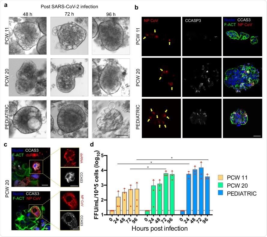 SARS-CoV-2 infection of human fetal and pediatric gastric organoids