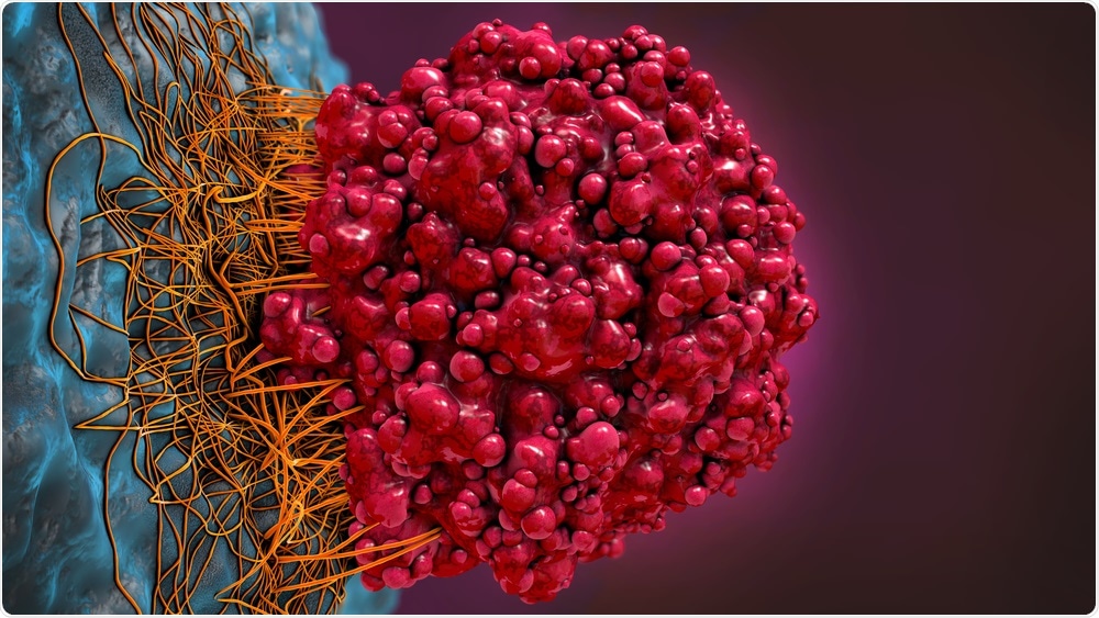 Tumor Cells Tumor Cells