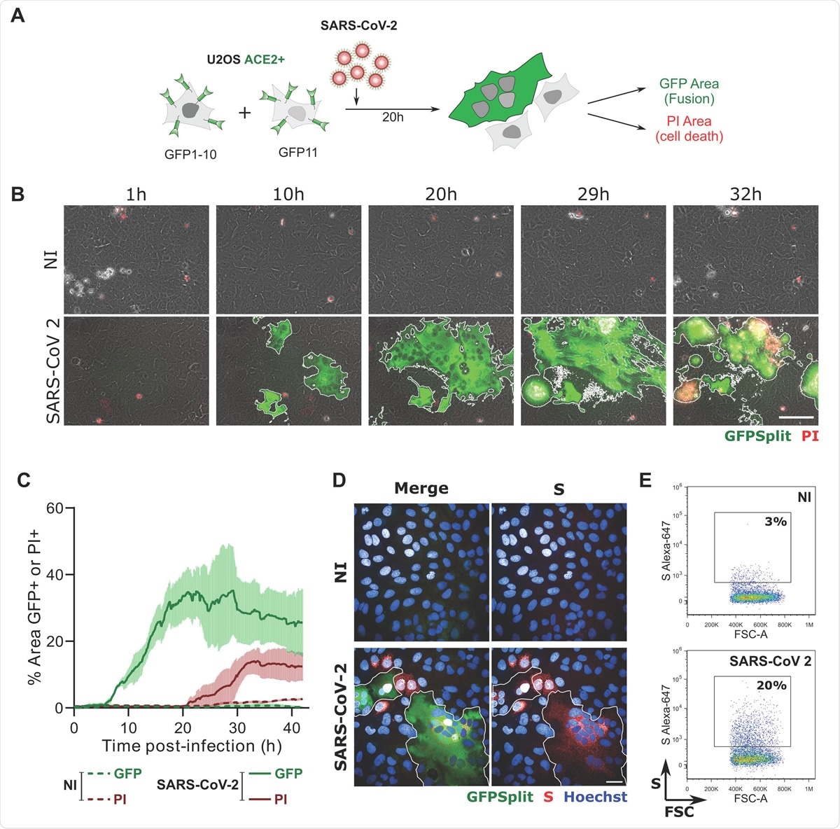 SARS-CoV-2 induced syncytia formation. A. GFP-Split U2OS-ACE2 were co-cultured at a 1:1 ratio and infected with SARS-CoV-2. Syncytia formation and cell death was monitored by video microscopy or at endpoint using confocal microscopy and high content imaging. B. Still images of GFP (syncytia) and Propidium Iodide (PI) (cell death) at different time-points. Scale bar: 100 μm. C. Quantification of U2OS-ACE2 fusion and death by time-lapse microscopy. Results are mean±sd from 3 fields per condition. D. S staining of infected U2OS-ACE2 cells analyzed by immunofluorescence. The Hoechst dye stains the nuclei. Scale bar: 40 μm. E. Surface S staining of infected U2OS-ACE2 cells analyzed by flow cytometry. Results are representative of at least three independent experiments.