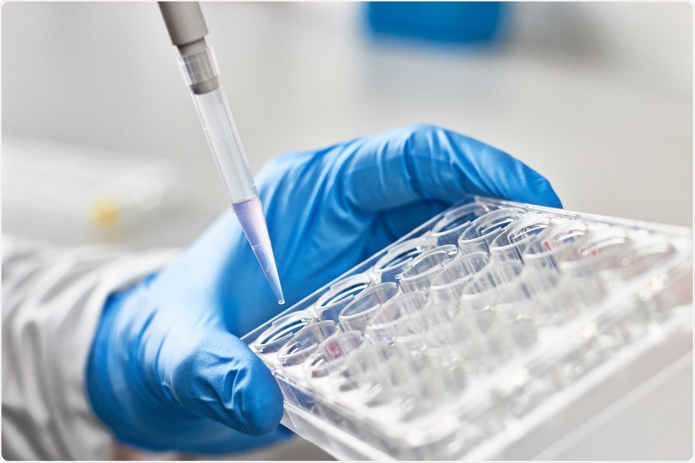 Study: Poor correlation between antibody titers and neutralizing activity in sera from SARS-CoV-2 infected subjects. Image Credit: Catalin Rusnac / Shutterstock