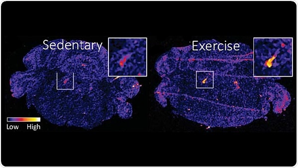 Exercise confers stress resilience by increasing brain protein levels