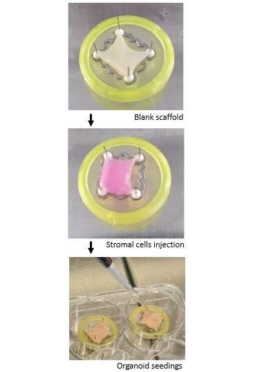 Intestinal grafts grown using stem cells could lead to personalized transplants for children