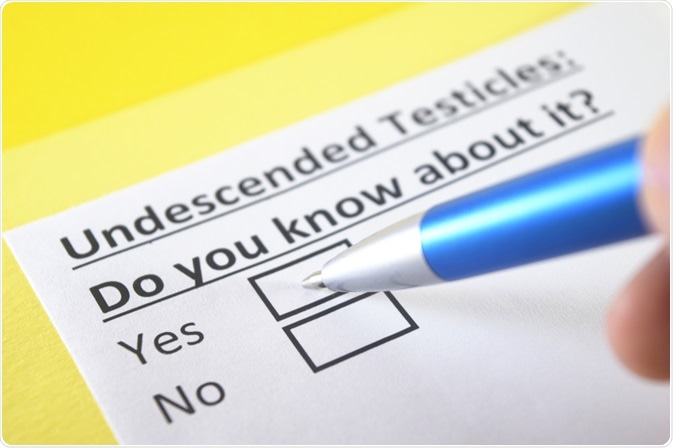 Undescended Testicles