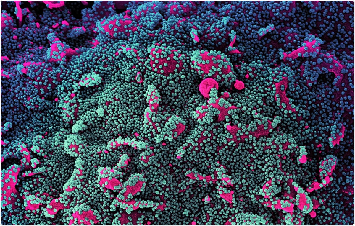Study: Impact of B.1.1.7 variant mutations on antibody recognition of linear SARS-CoV-2 epitopes. Image Credit: NIAID