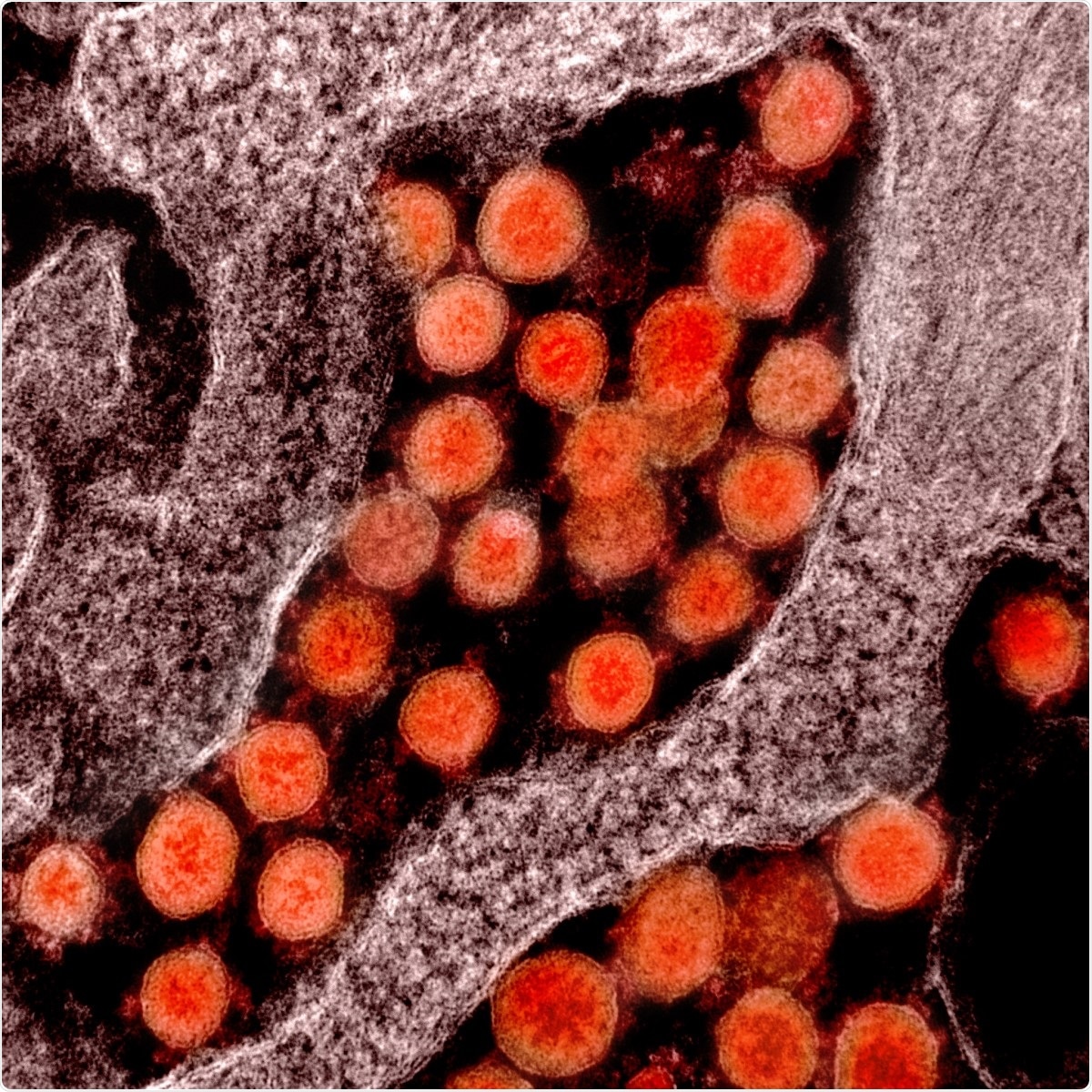Study: Comprehensive comparison of transcriptomes in SARS-CoV-2 infection: alternative entry routes and innate immune responses. Image Credit: NIAID / Flickr
