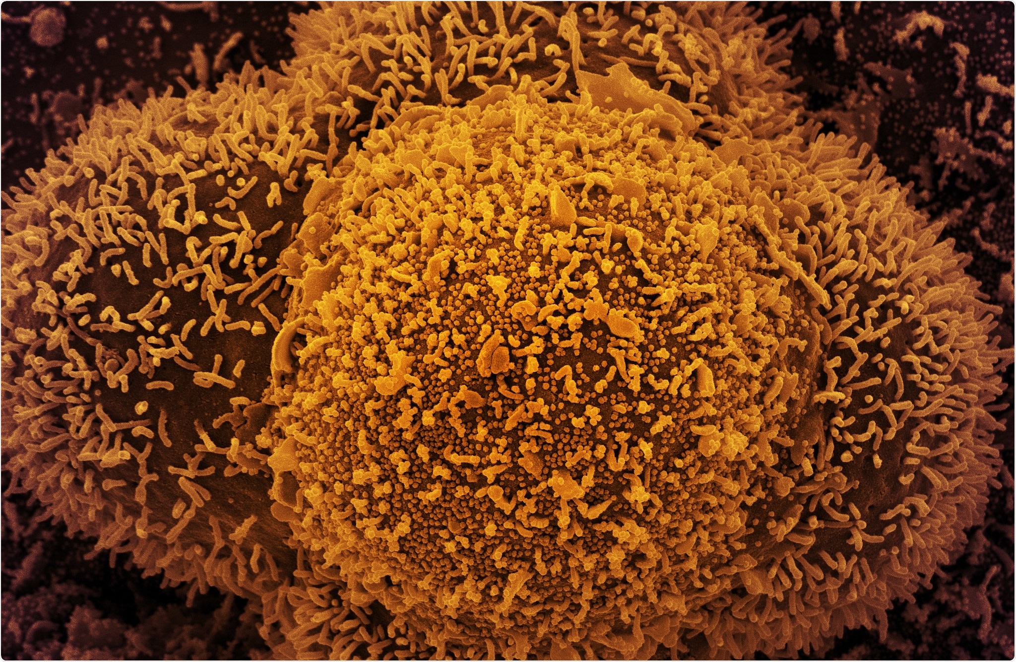 Study: In vivo structure and dynamics of the RNA genome of SARS-Cov-2. Image Credit: NIAID