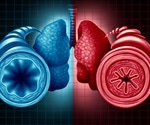 What is Asthma?