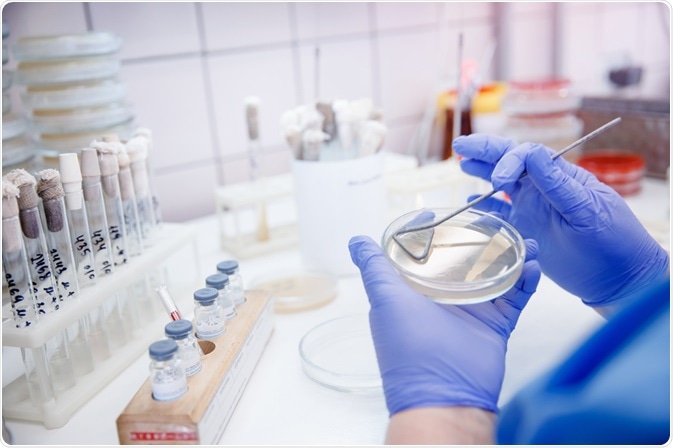 microbial identification