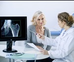 Causes of Osteoporosis