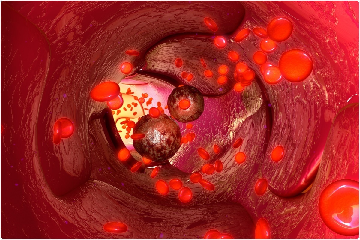 Study: Immunoengineered Nanobead System for the Isolation and Detection of Circulating Tumor Cells. Image Credit: sciencepics / Shutterstock