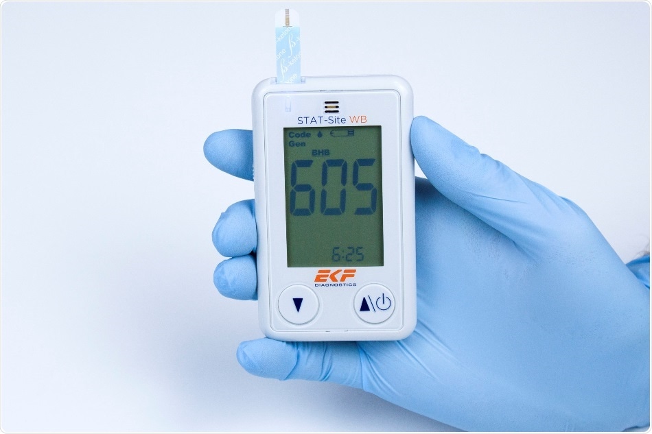 EKF Diagnostics to exhibit new STAT-Site WB β-ketone and glucose handheld analyzer at Medica 2021