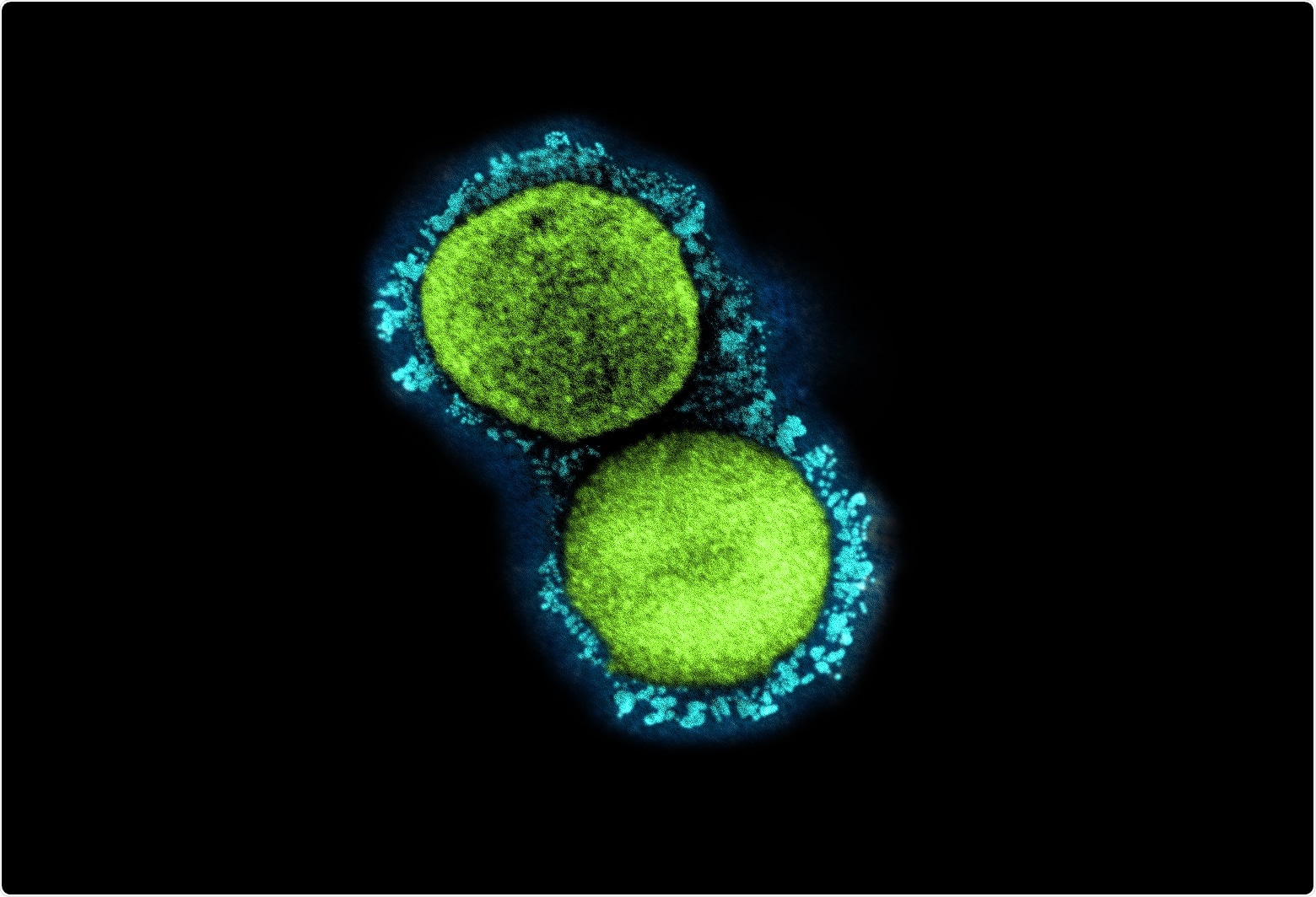 Study: Comparison of Plaque Size, Thermal Stability, and Replication Rate among SARS-CoV-2 Variants of Concern. Image Credit: NIAID