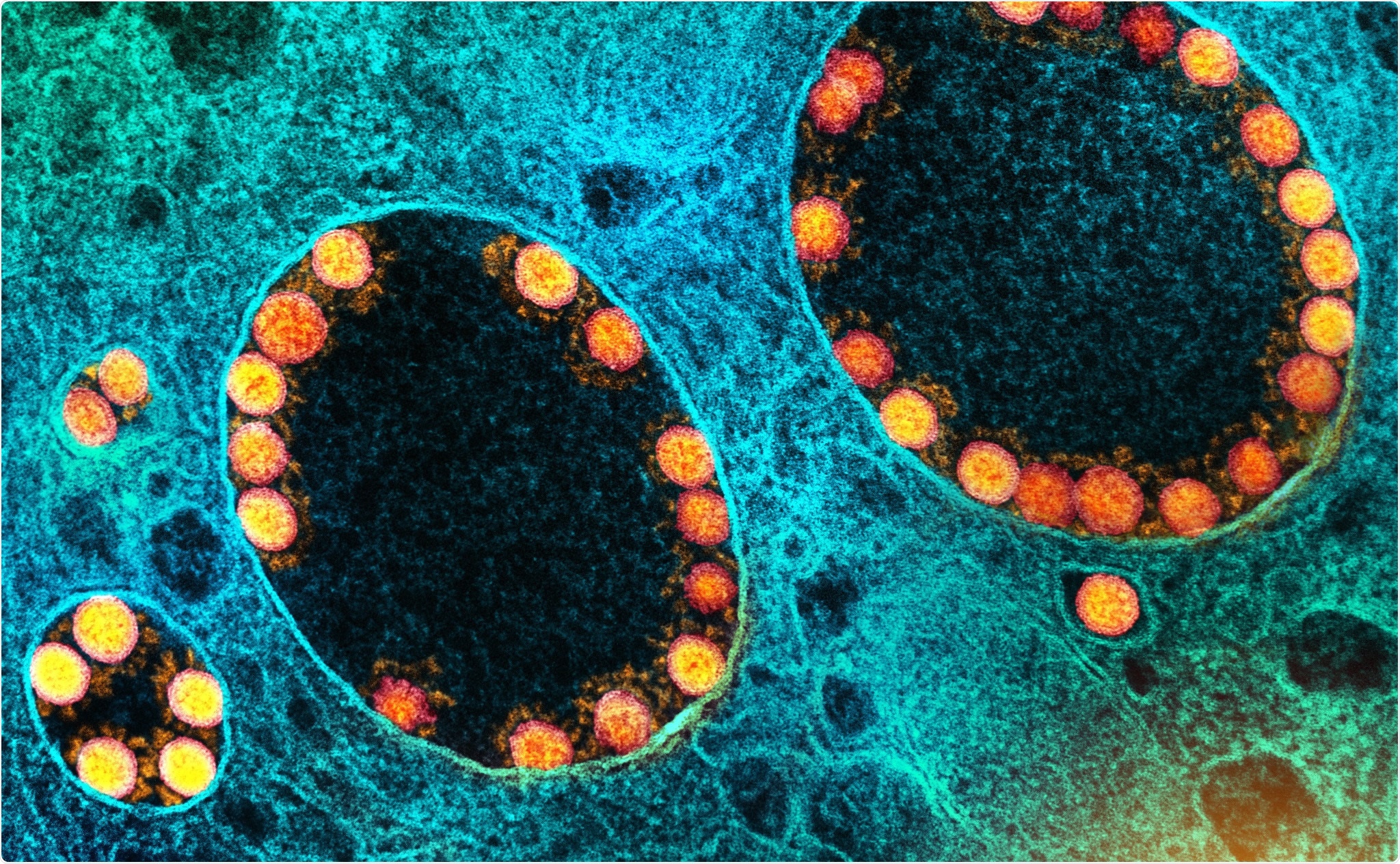 Study: An objective systematic comparison of the most common adverse events of COVID-19 vaccines. Image Credit: NIAID