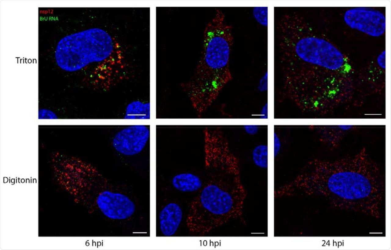 Viral RNA synthesis takes place in a membrane-bound compartment. DF1 cells were infected with IBV. 30 mins prior to fixation, cells were treated with BrU and ActD. Cells were fixed at the indicated times post infection. Cells were permeabilized with Triton X-100 (all membranes; top row) or digitonin (plasma membrane; bottom row) then labeled for nsp12 (red) and BrU (green), nuclei labeled with DAPI (blue). Scale bars represent 5 μm