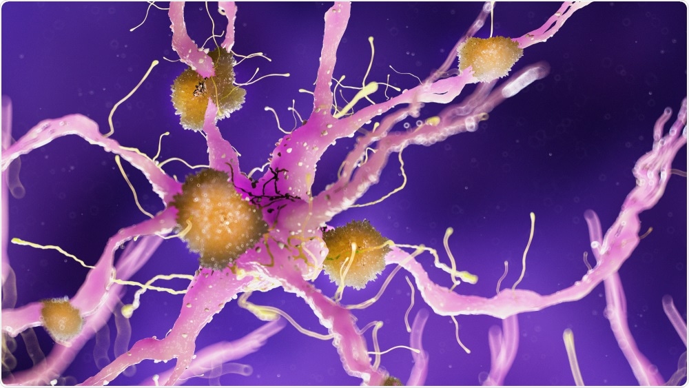 Study: NHE6 depletion corrects ApoE4-mediated synaptic impairments and reduces amyloid plaque load. Image Credit: SciePro / Shutterstock