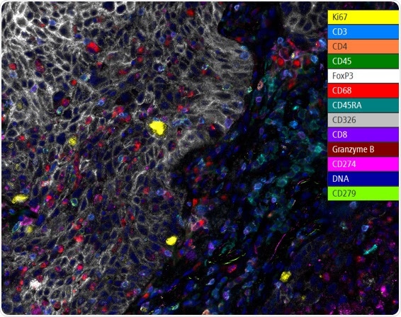 Fluorescent image of human lung cancer FFPE sample with 13 protein biomarkers illuminated using the Spatial Immune Profiling Kit for ChipCytometry.