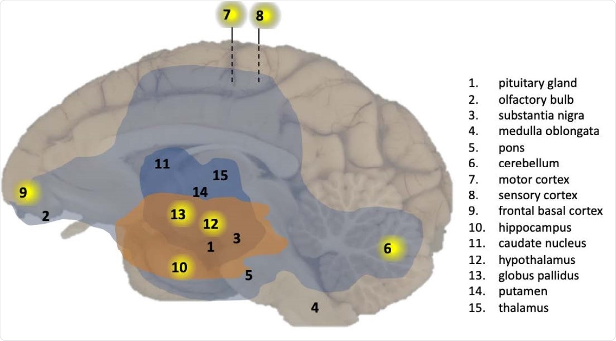 Overview of CNS effects by SARS-CoV-2 exposure in a macaque brain. Presence of viral RNA was investigated in multiple regions of the brain as indicated by the numbers. Viral RNA-positive regions in cynomolgus macaque C3 are indicated by a yellow background. The analysed brain regions are indicated with a number. Brain areas with T-cells (CD3+) and activated microglia (Mamu-DR+) are shown in light blue (mild expression) and dark blue (moderate expression), respectively. Brain areas with Lewy bodies (a-synuclein+) are shown in orange.