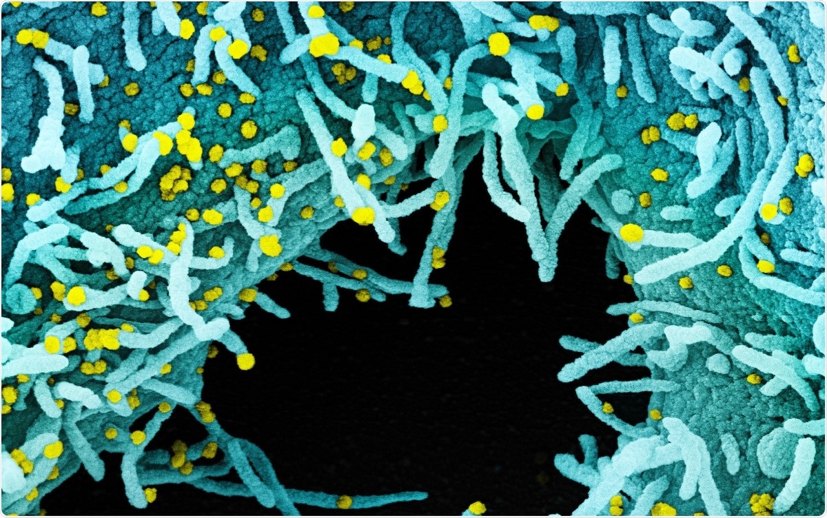 Study:  Symptoms of COVID-19 infection and magnitude of antibody response in a large community-based study. Image Credit: / Shutterstock