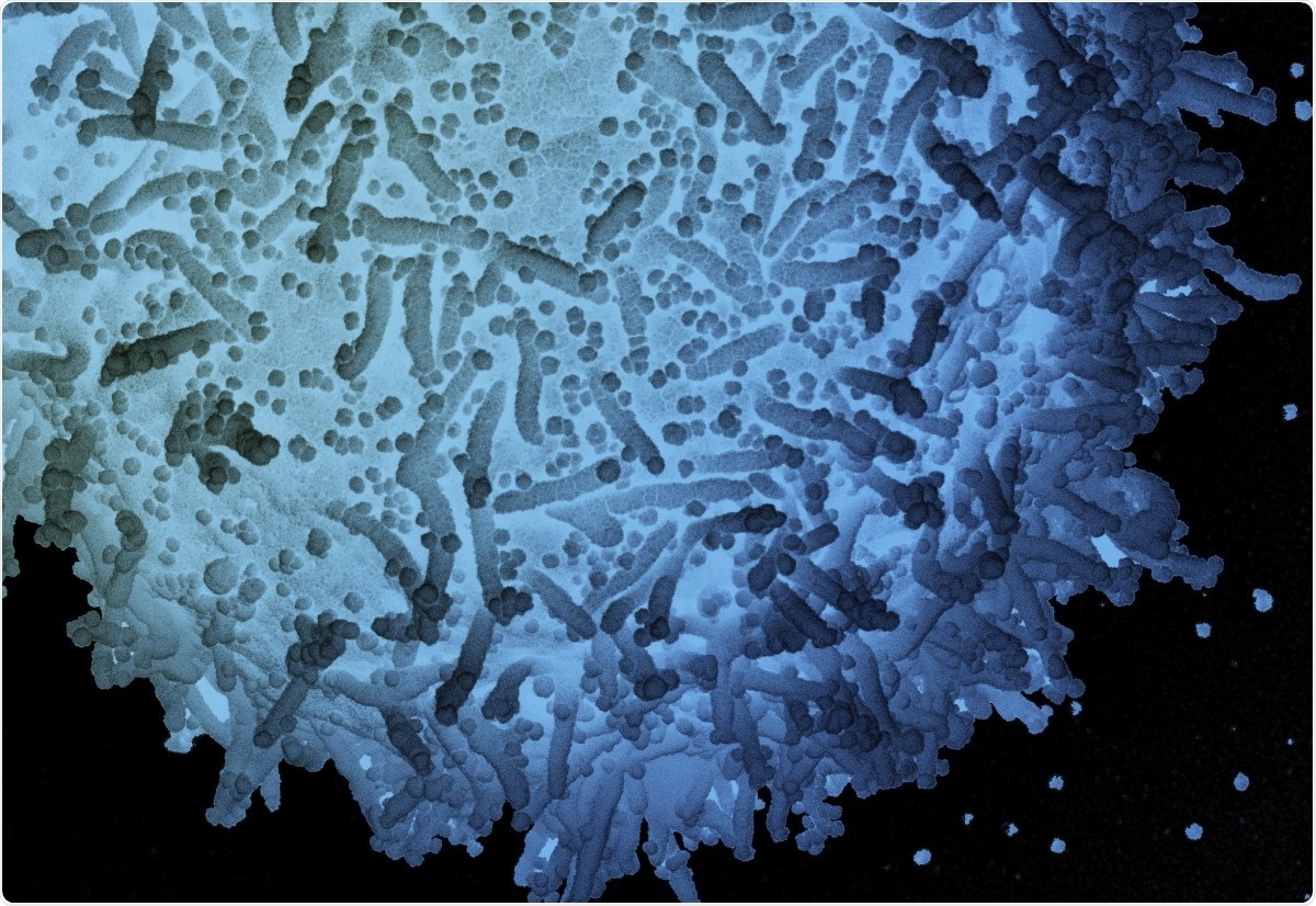 Study: Graphene Sheets with Defined Dual Functionalities for the Strong SARS‐CoV‐2 Interactions. Image Credit: NIAID / Flickr