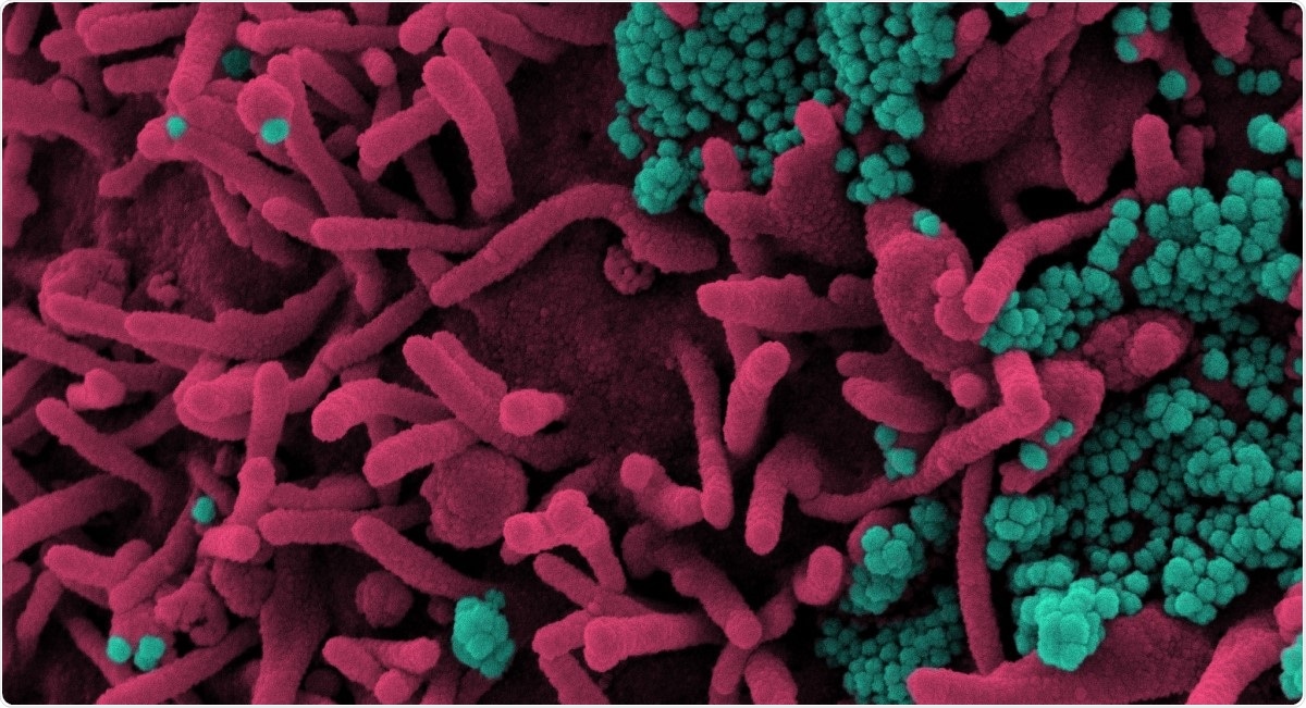 Study: A novel glucocorticoid and androgen receptor modulator reduces viral entry and innate immune inflammatory responses in the Syrian Hamster model of SARS-CoV-2. Image Credit: NIAID / Flickr