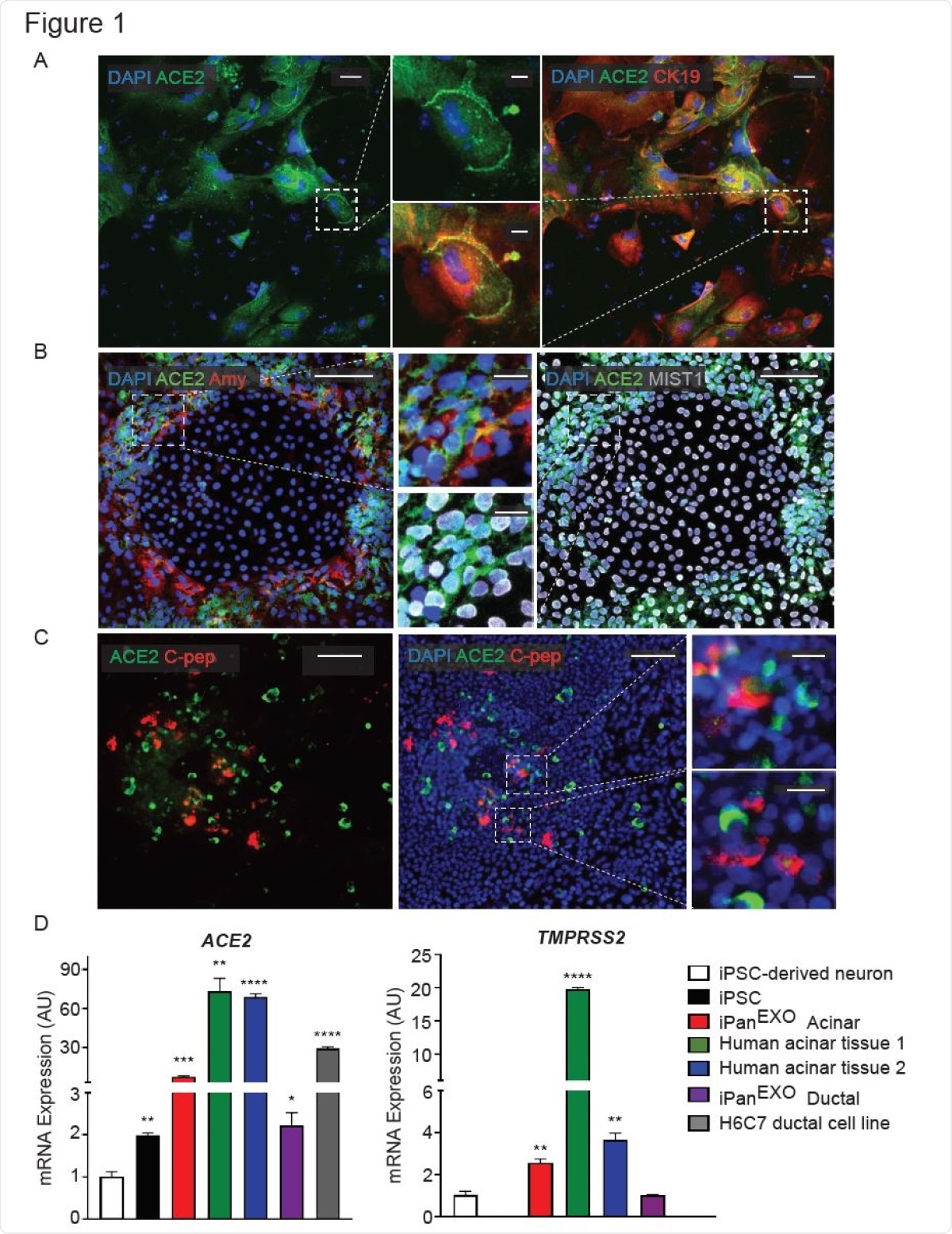 Expression of ACE2 and TMPRSS2 in exocrine pancreatic cells. A. iPanEXO Ductal cells CK19 (red) exhibiting ACE2 (green) expression. B. iPanEXO Acinar cells Amylase (red), MIST1 (gray) exhibit ACE2 (green) expression. C. iPanEXO Acinar and iPanENDO cultures contain some endocrine C-peptide expressing cells, which also co-stain with ACE2. D. iPSC-derived pancreatic exocrine cells as well as human acinar tissues and human ductal cell line H6C7 express ACE2 and TMPRSS2. Data is shown as mean ± SEM with statistical significance determined by unpaired two-tailed t-test. *p<0.05, **p <0.01, ***p<0.001, ****p<0.0001. Scale bar represents 100 μm, and 20 μm for zoomed panels adjacent to main images.