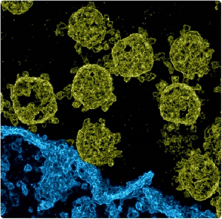 Image of SARS-CoV-2 viruses in Vero cell cultures. We used data made available by Laue et al. (2021) who used transmission electron microscopy of ultrathin plastic sections. Based on the data, we estimated pixel variances during the application of probabilistic Machine Learning algorithms for denoising (Sheikh et al., 2014; Monk et al., 2018; Drefs et al., 2020). The resulting image of these variances gives a spatial impression (also see Supplementary Figure 1, which shows a close comparison between a section of the noisy EM image and the corresponding estimated pixel variances). The here shown image was then obtained after contrast enhancement and colorization: structures that we manually identied as belonging to a cell were colored in blue (lower right area), the remainder was colorized in yellow.