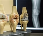 What is Osteoarthritis?
