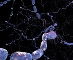 What is Demyelination?