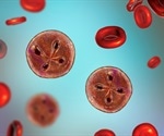Diagnosis of Babesiosis