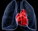 Incidence of cardiometabolic and pulmonary events in UK has lowered due to COVID-19