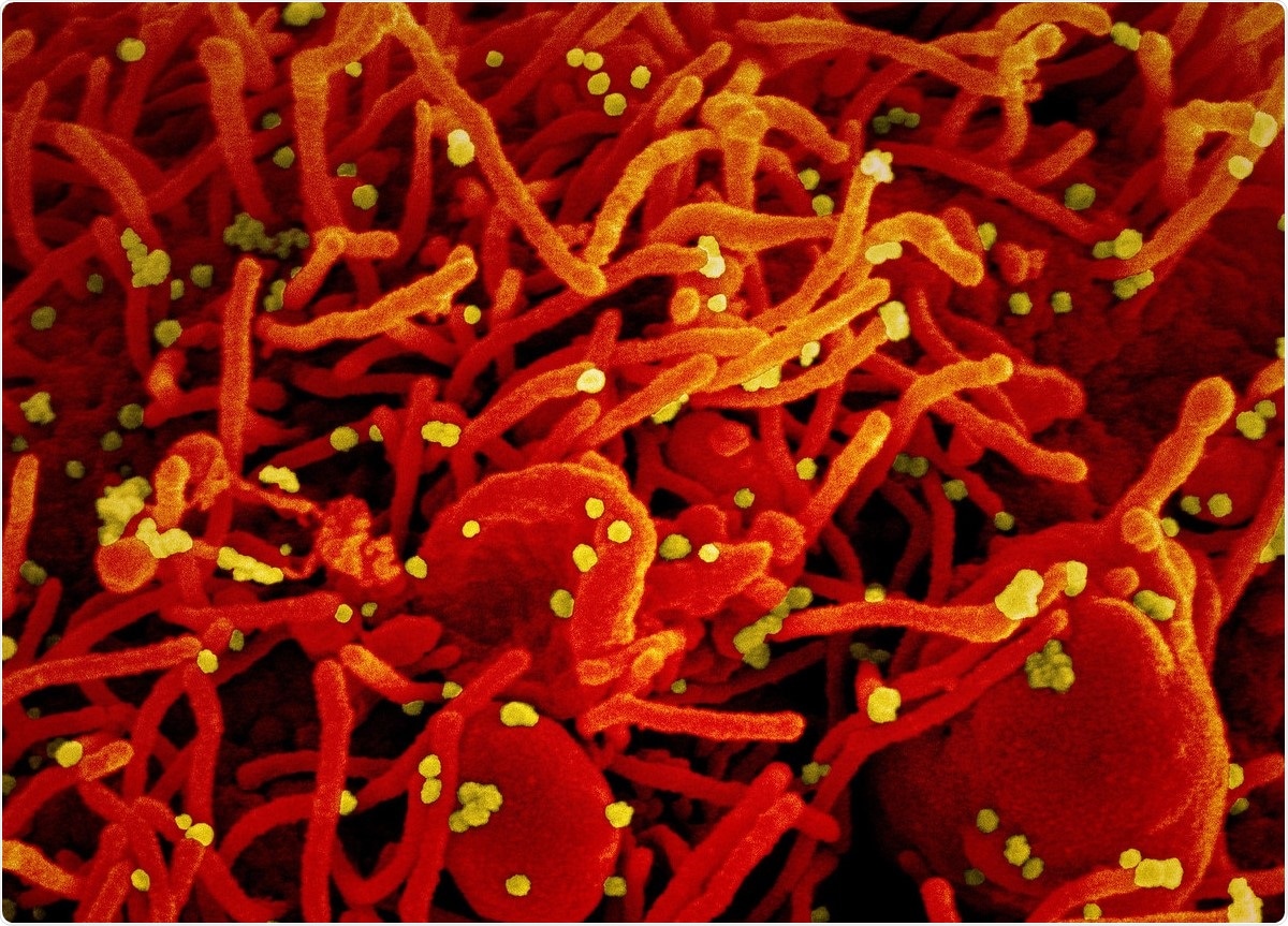 Study: Interferon Resistance of Emerging SARS-CoV-2 Variants. Image Credit: NIAID / Flickr