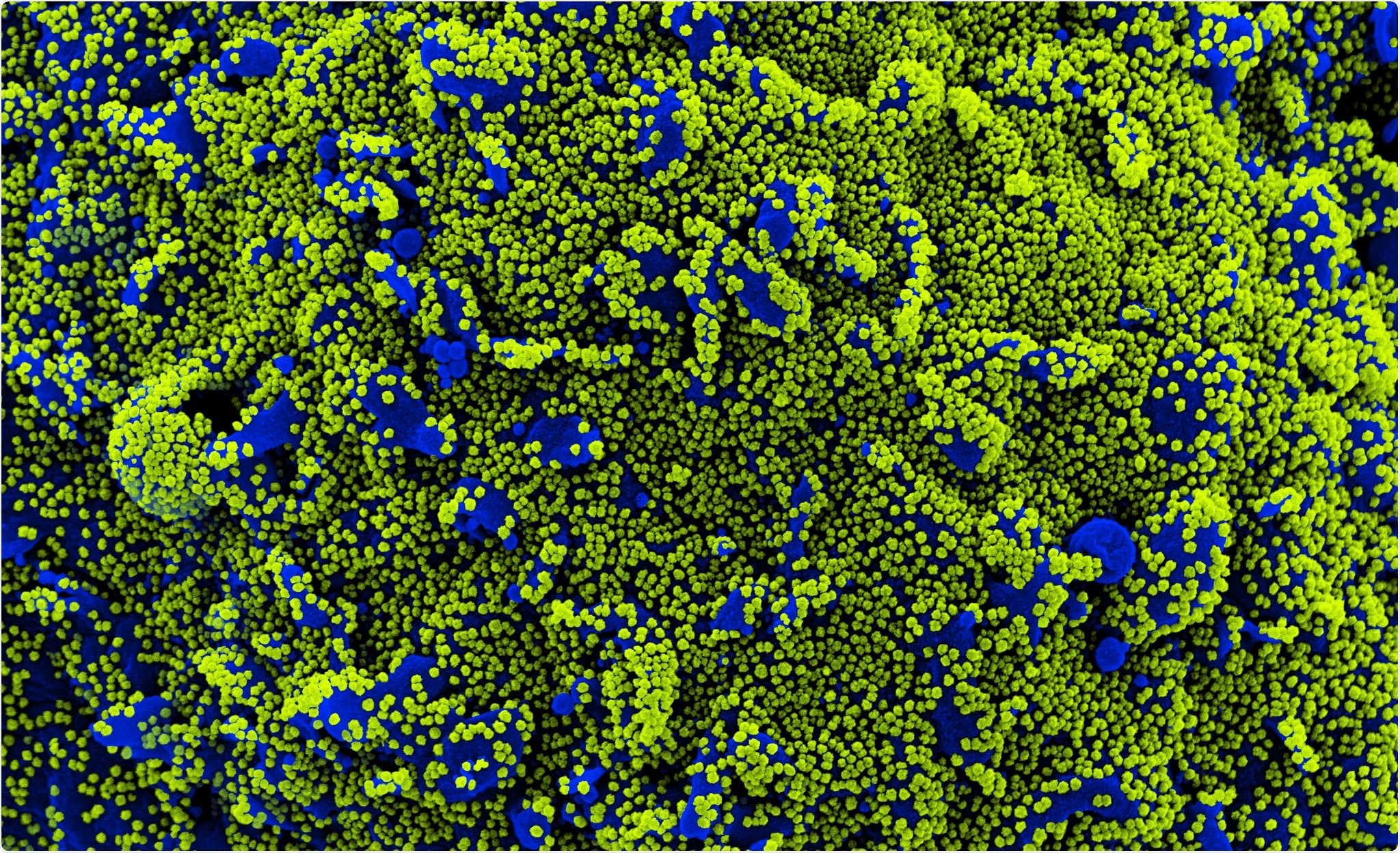 Study: Chimeric spike mRNA vaccines protect against sarbecovirus challenge in mice. Image Credit: NIAID