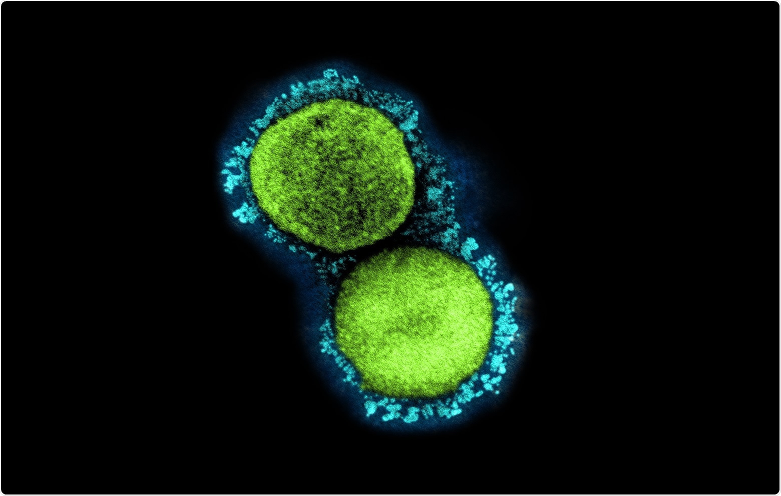 Study: Saliva testing is accurate for early-stage and presymptomatic COVID-19. Image Credit: NIAID