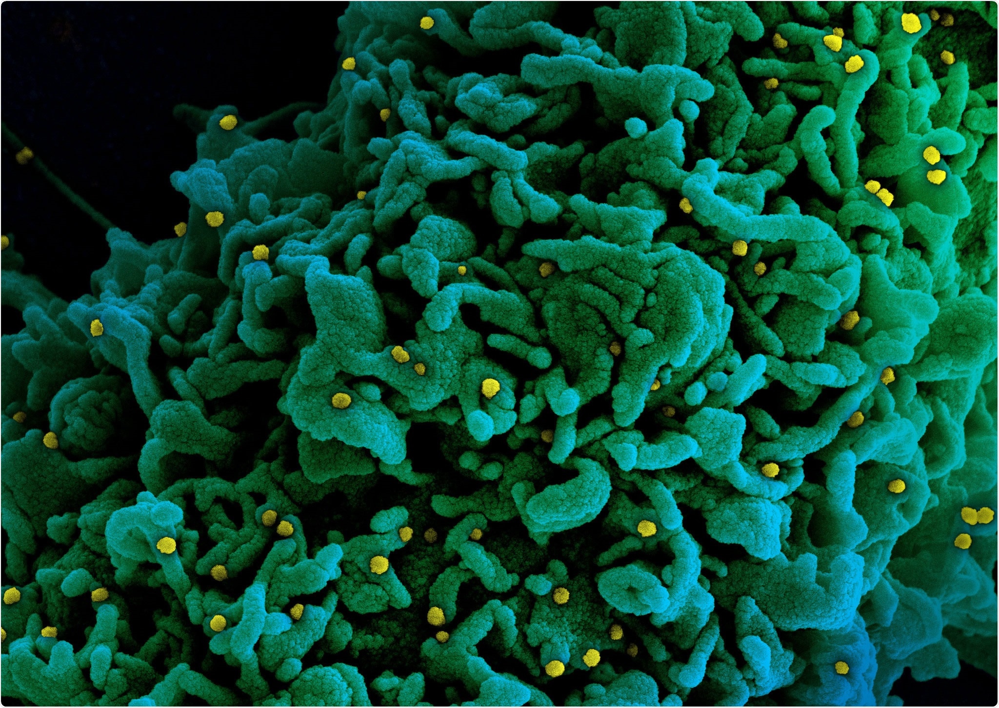 Study: A robust SARS-CoV-2 replication model in primary human epithelial cells at the air liquid interface to assess antiviral agents. Image Credit: NIAID