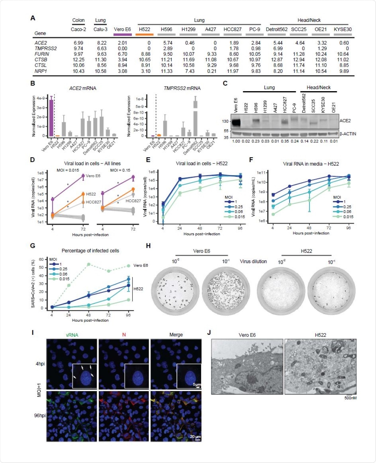 Expression of ACE2 across cell line models, related to Figure 1. A, Unsupervised hierarchical clustering of upper quartile-normalized RNA-seq reads. Normalized RNA-seq reads were aligned to the GRCh38 and Vervet-African green monkey genomes and quantified with Salmon (v1.3.0). As indicated, RNA-seq data were generated at UNC or Washington University or obtained from the Sequence Read Archive (SRA). B, Read counts for ACE2, GAPDH and ACTB across the indicated cell models.