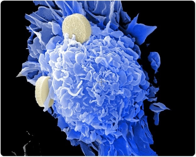 Review helps understand the mechanisms of R-CHOP resistance in diffuse large B-cell lymphoma