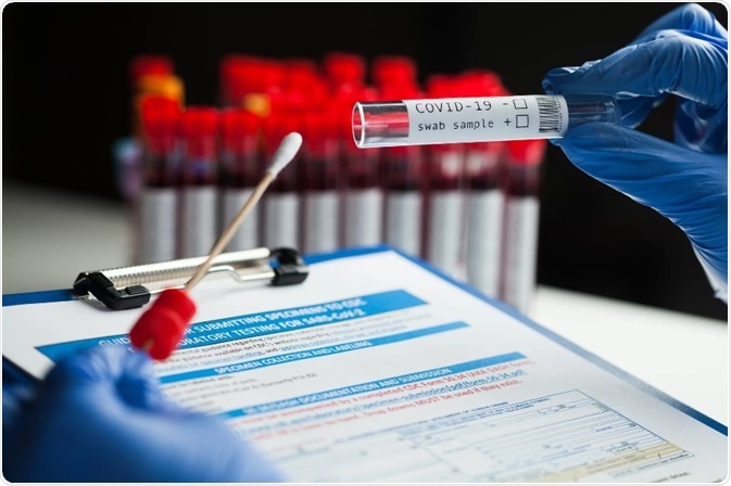Sample Preparation for COVID-19 Testing with the Multi Reax Vortexer